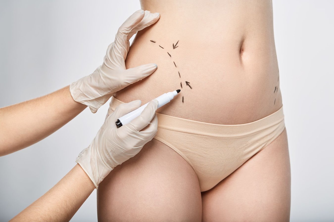 Injection Lipolysis