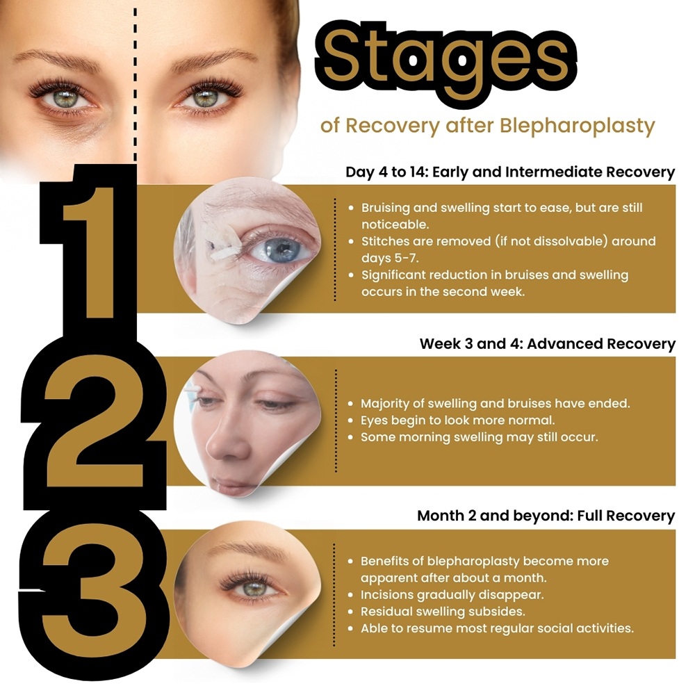 Blepharoplasty